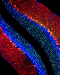 neuroplasticity and neurons