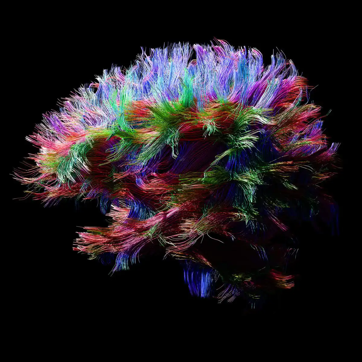 A colorful representation of brain connections